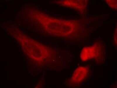 STAT1 [p Ser727] Antibody (NB100-82209): Novus Biologicals